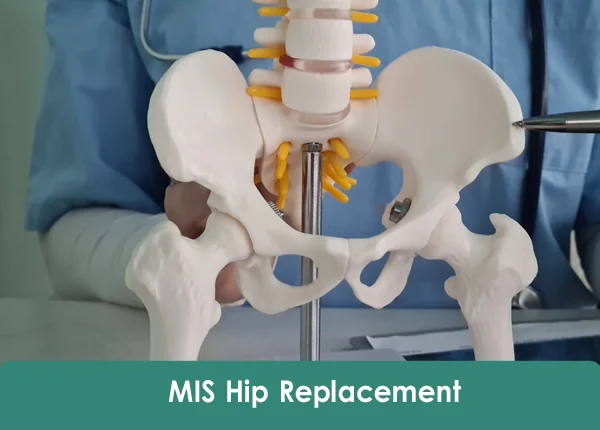 MIS Hip Replacement