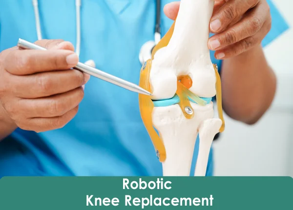 Robotic Knee Replacement